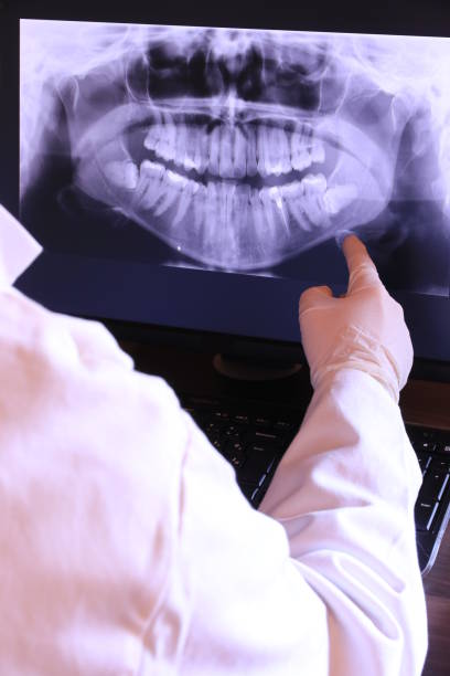 Best Emergency Treatment for Oral Infections in Loyalhanna, PA